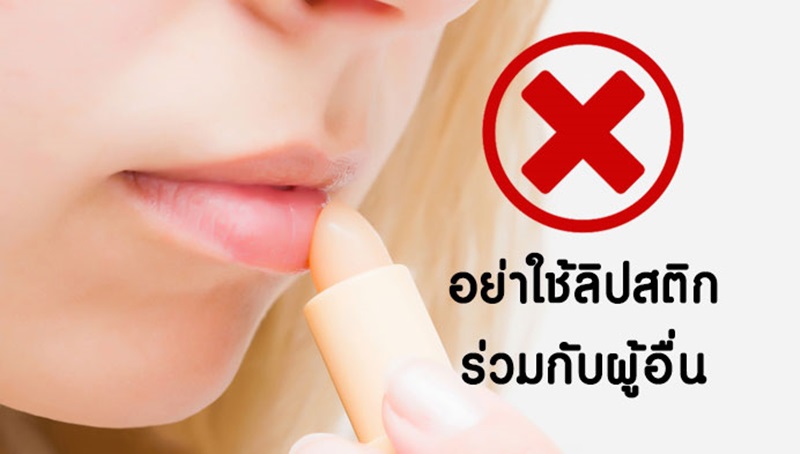 โรคเริม ที่ปาก เกิดจากอะไร มีวิธีดูแลรักษา และป้องกันอย่างไร?